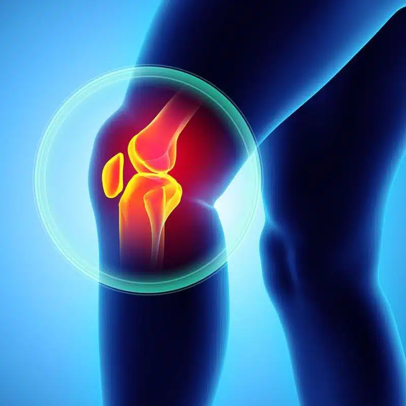 Tendinopatía rotuliana anatomía