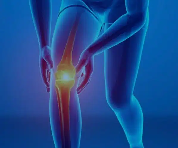 Lesión de rodilla