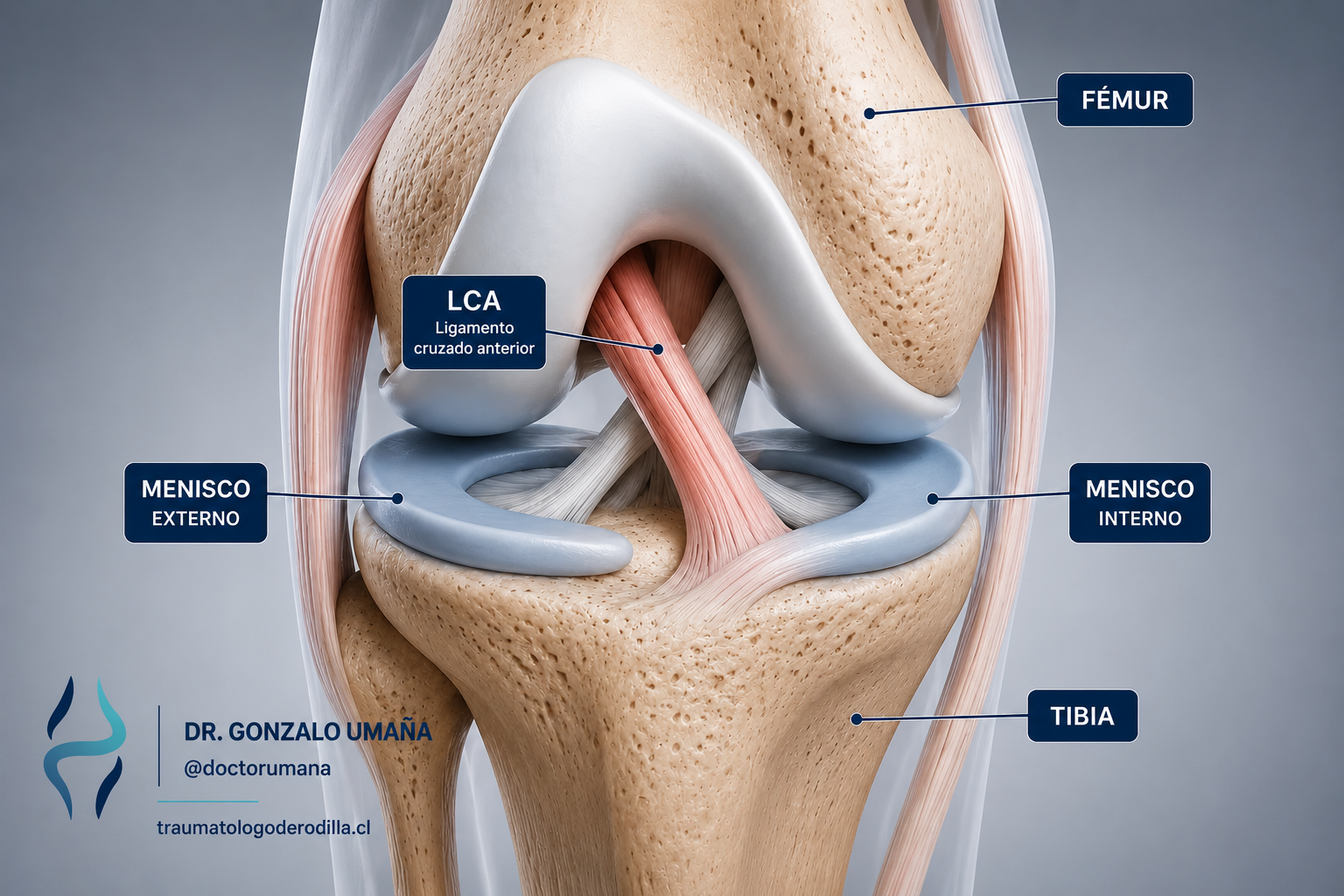 Anatomía de la rodilla con ligamento cruzado anterior, fémur, tibia y meniscos señalados.