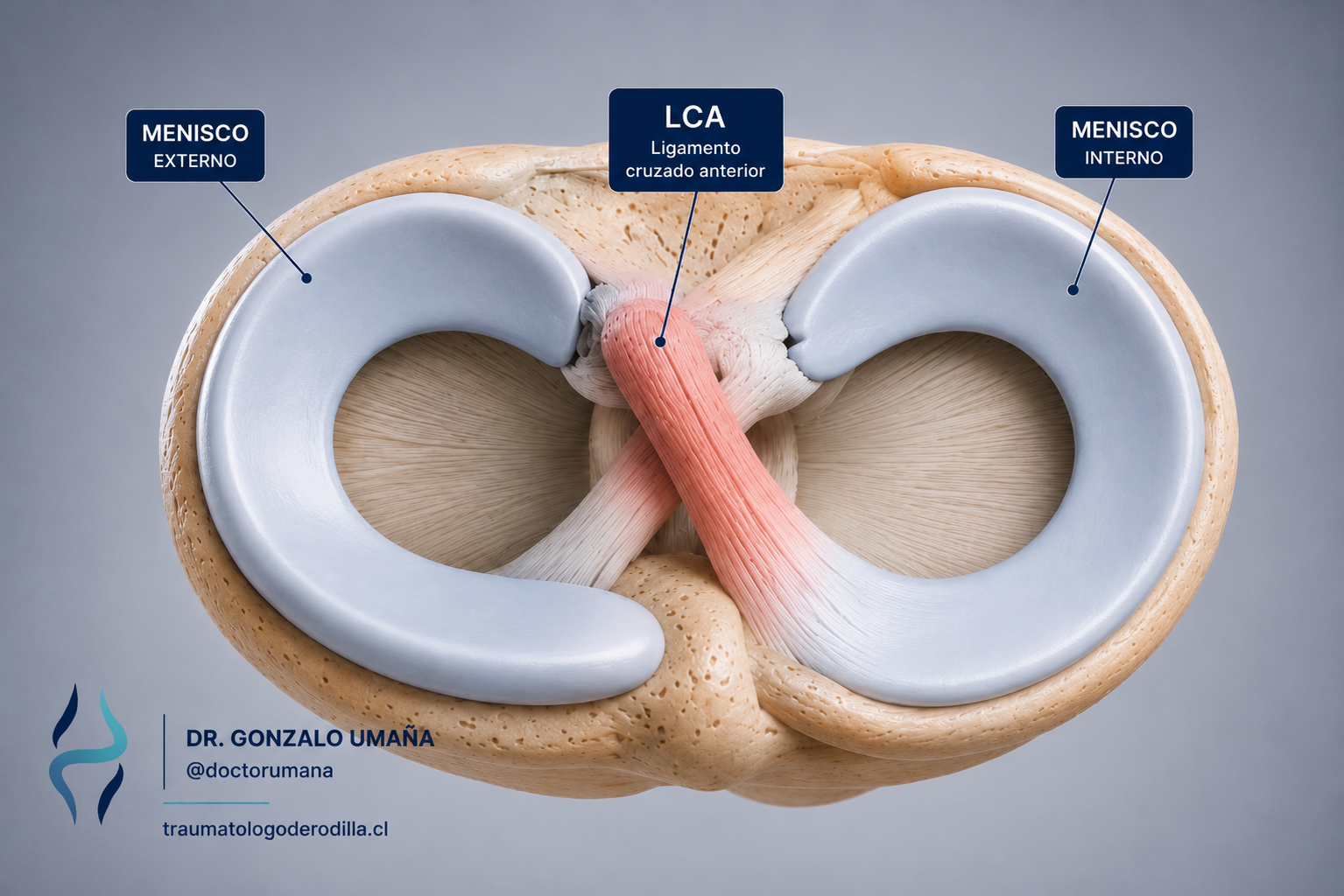 Vista superior de la rodilla mostrando el ligamento cruzado anterior y ambos meniscos.